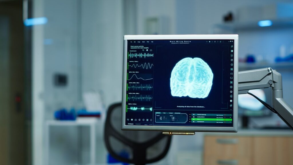 Computer monitor displaying brain scan and activity data in a scientific laboratory setting.