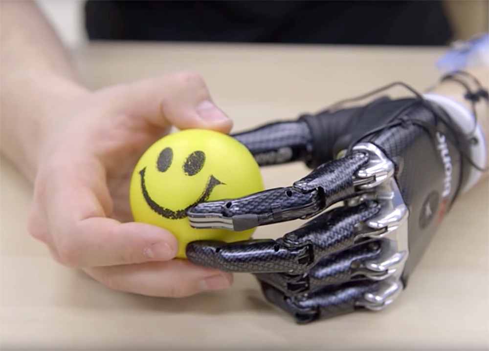 A prosthetic hand holding a yellow smiley face stress ball.